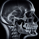 МРТ скронево-нижньощелепного суглоба